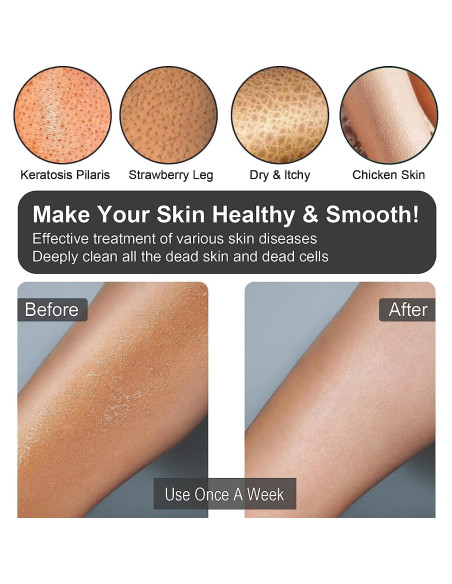 Guantes Exfoliantes Yiclick 12 Pares para Baño Ducha