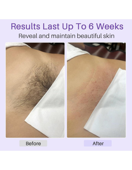 Kit de Depilación con Cera Dura BLITZWAX 120 Piezas