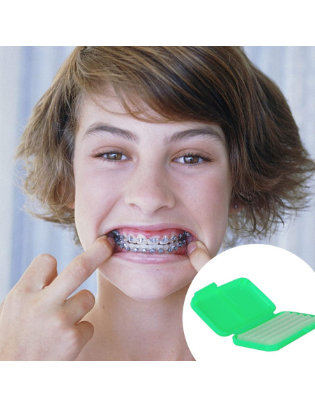 Cera Dental MorTime 12 Pack para Brackets y Alineadores