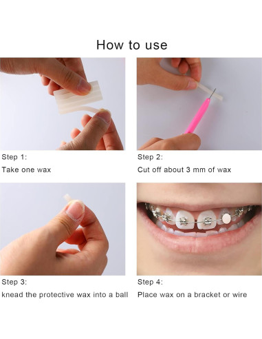 Cera Dental MorTime 12 Pack para Brackets y Alineadores