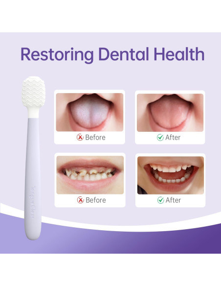 Raspador de Lengua para Bebés Tongueclear Tonkidbrush 360