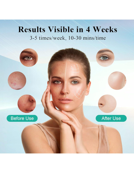 Máscara de Terapia de Luz LED Biuufish 7 Colores Antienvejecimiento