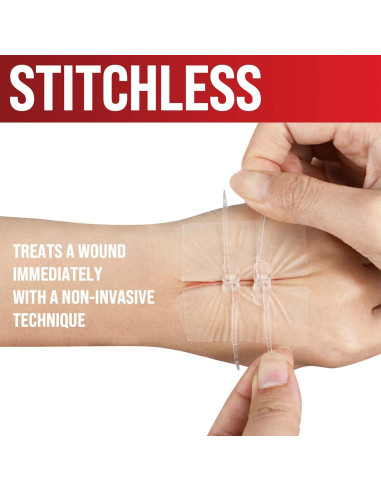 Tiras de Cierre de Heridas MyHelp - 2 Pack - Vendajes en Mariposa