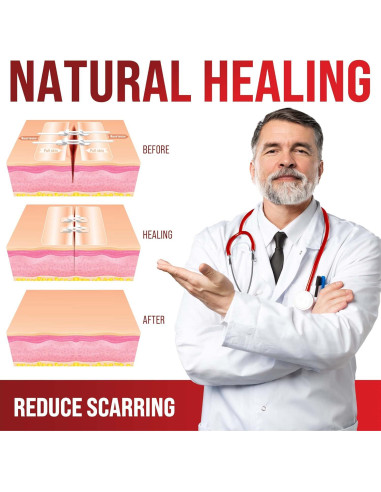 Tiras de Cierre de Heridas MyHelp - 2 Pack - Vendajes en Mariposa