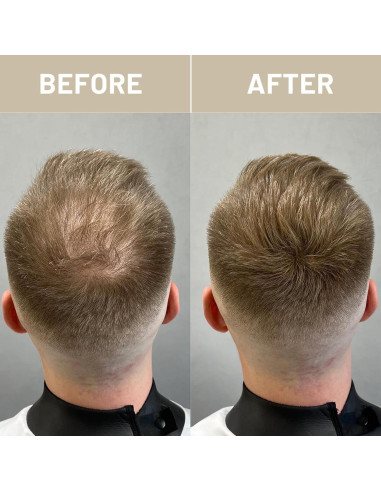 Fibras para Cabello VOLLUCK 28g Castaño Rojizo - Cobertura Instantánea