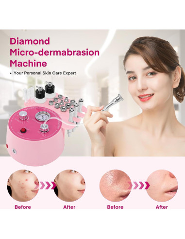 Máquina de Microdermoabrasión Yofuly 3 en 1 Rosa - Cuidado Facial