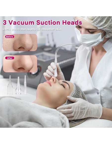 Máquina de Microdermoabrasión Yofuly 3 en 1 Rosa - Cuidado Facial