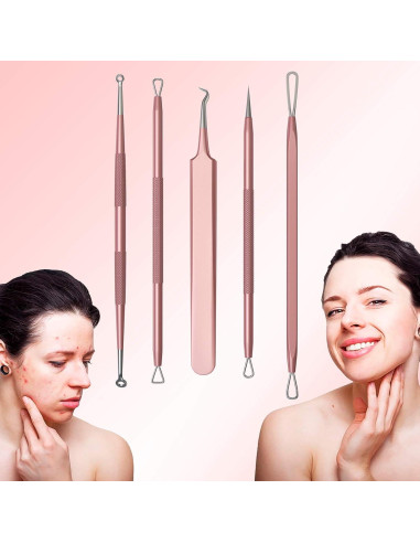 Kit de Extracción de Puntos Negros MelodySusie - Acero Inoxidable