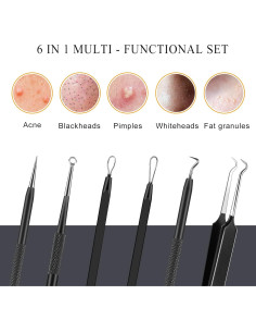 Kit de Herramientas para Espinillas Boxoyx - 6 Piezas Acero Inoxidable 2