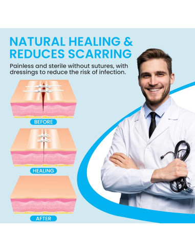 Tiras de Cierre de Heridas Antaly - Kit 4 Paquete Transpirables