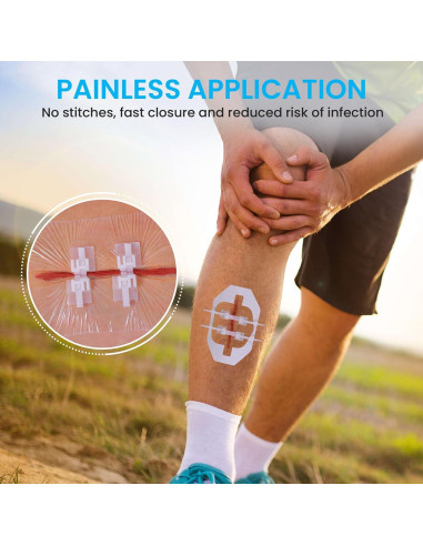 Tiras de Cierre de Heridas Antaly - Kit 4 Paquete Transpirables