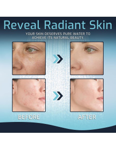 Cabezal de Ducha Filtrado Mist MSS081, 15 Etapas, Cromo 2