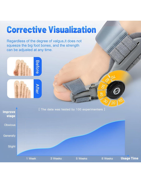 Corrector de Juanetes Qlonn Ajustable para Alivio de Dolor
