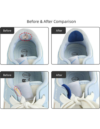 6 Parches Autoadhesivos ZHIZHOUNEY para Reparación de Calzado