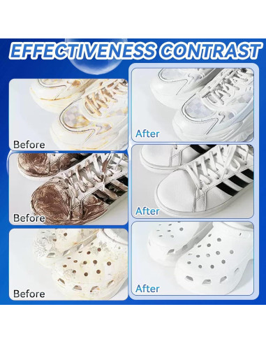 Kit Limpiador de Zapatos Blancos Balldanlu 200ml con Cepillo