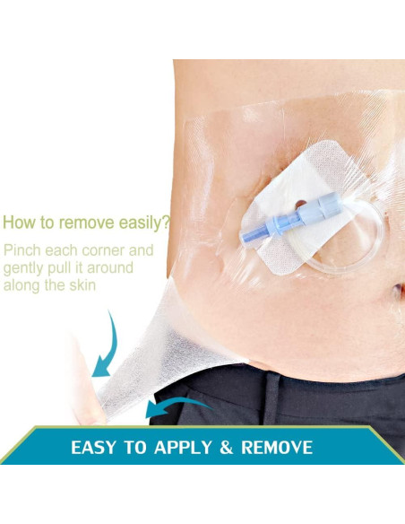 Vendaje Impermeable Post-Tatuaje Hola Health 15.24x15.24 cm (50 pcs)