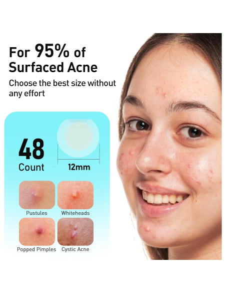 Parche para Acné TKTK 12mm Hidrocoloide 48 Unidades Parche para Acné TKTK 12mm Hidrocoloide 48 Unidades