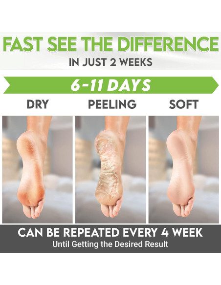 Mascarilla Exfoliante para Pies Karma Organic - Té Verde Hidratante, 2 Unidades