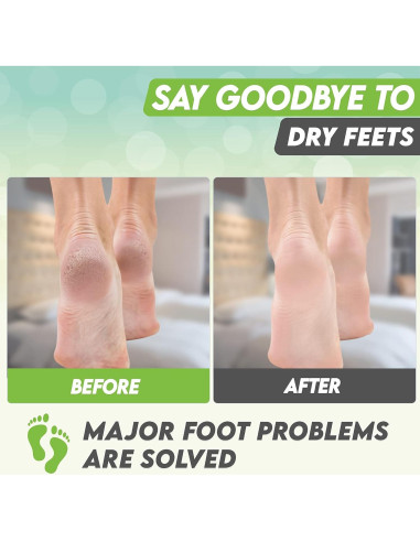 Mascarilla Exfoliante para Pies Karma Organic - Té Verde Hidratante, 2 Unidades