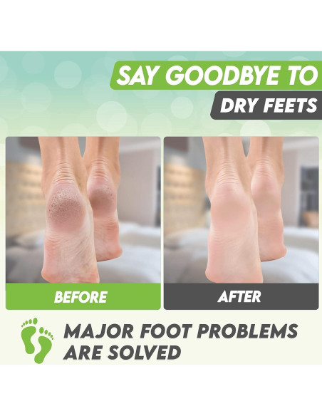 Mascarilla Exfoliante para Pies Karma Organic - Té Verde Hidratante, 2 Unidades