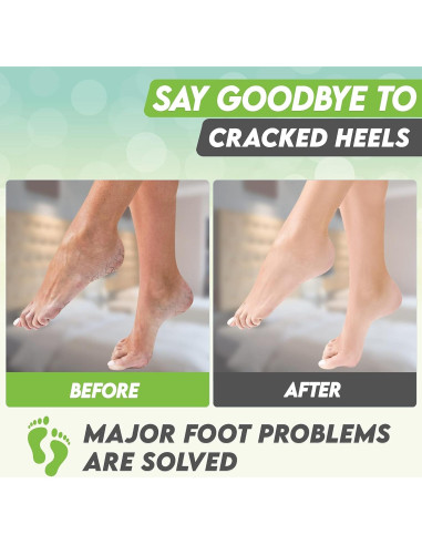 Mascarilla Exfoliante para Pies Karma Organic - Té Verde Hidratante, 2 Unidades