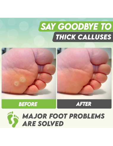 Mascarilla Exfoliante para Pies Karma Organic - Té Verde Hidratante, 2 Unidades