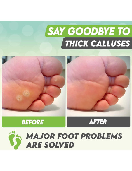 Mascarilla Exfoliante para Pies Karma Organic - Té Verde Hidratante, 2 Unidades