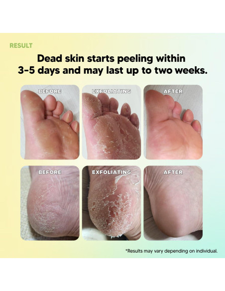 Máscara Exfoliante para Pies F3 Systems - Peeling AHA/BHA 159g