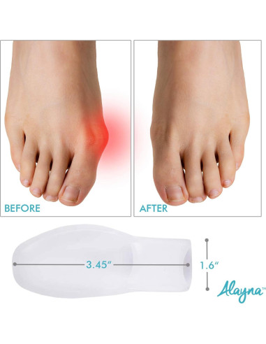 Separadores de Dedos Alayna Corrector de Juanetes Gel 2 Pcs