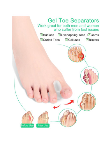 Separadores de Dedos de Gel Samaya Home - 12 Piezas Grande