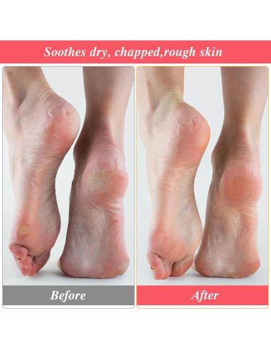 3 Pares Calcetines Hidratantes de Algodón para Pies - Rosa