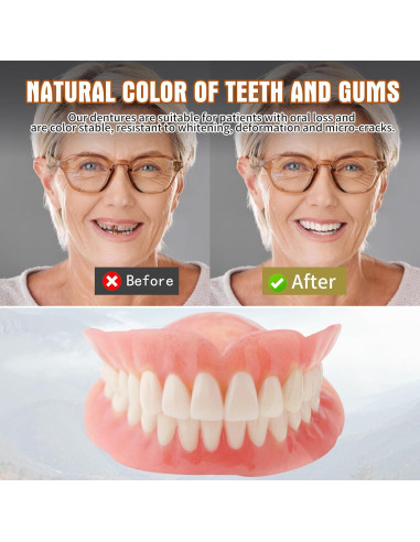 Kit de Dentaduras DIY Completo Dianww - Reparación Temporal de Dientes