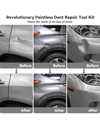 Kit de Reparación de Abolladuras DentWiz - Profesional Completo