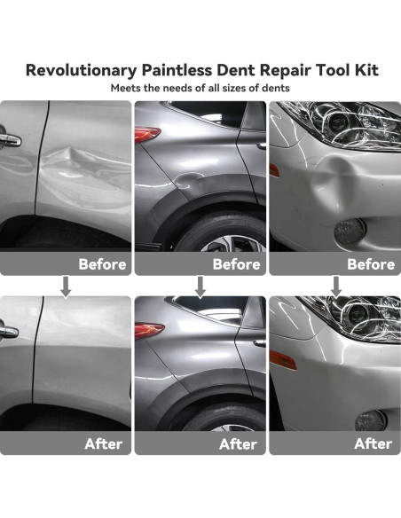 Kit de Reparación de Abolladuras DentWiz - Profesional Completo