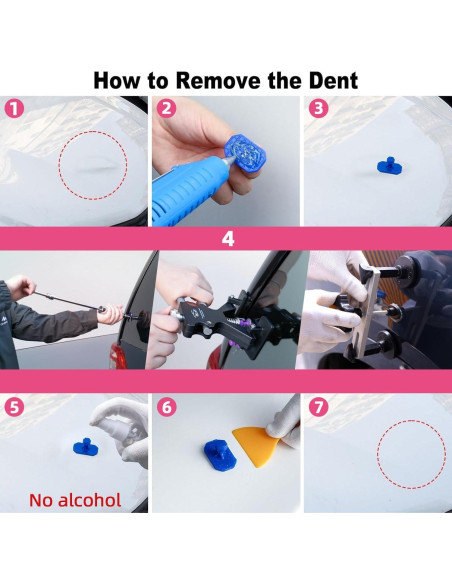 Kit de Reparación de Abolladuras DentWiz - Profesional Completo