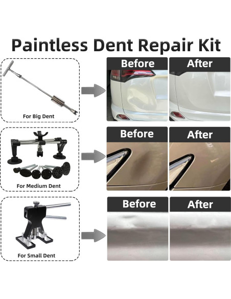 Kit de Reparación de Abolladuras Sin Pintura Chymogul DTZ168
