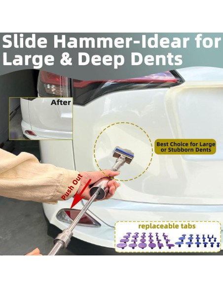 Kit de Reparación de Abolladuras Sin Pintura Chymogul DTZ168