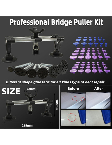 Kit de Reparación de Abolladuras Sin Pintura Chymogul DTZ168