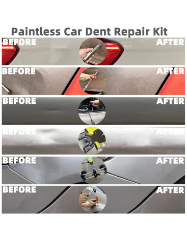 Kit de Reparación de Abolladuras Sin Pintura Chymogul DTZ168