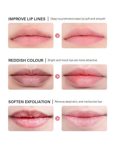 Conjunto de 5 Mascarillas Labiales Hidratantes Caedelfly