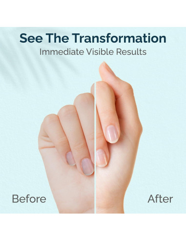 Crema Tratamiento Cutículas y Uñas ZMOI 28.35 g Hidratante