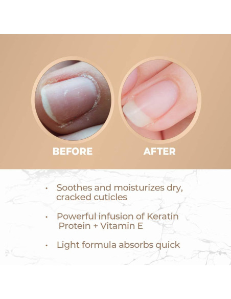 Aceite de Cutícula Seche Condition 14.79 ml - Hidratante y Fortalecedor