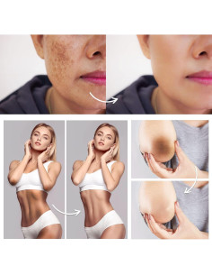 Crema Correctora de Manchas Famirosa - Piel Íntima y Axilas 2