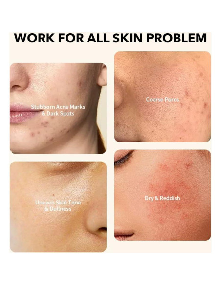 Suero Corrector de Manchas Oscuras NAILKISS 30ml