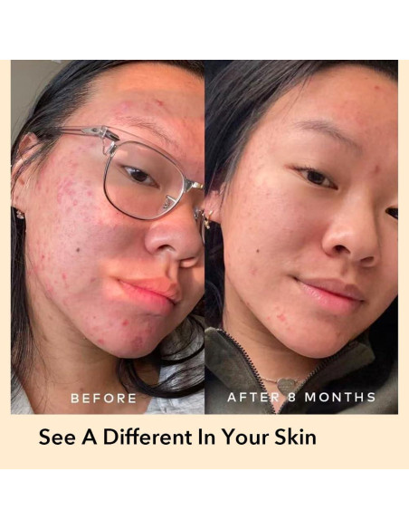 Suero Corrector de Manchas Oscuras NAILKISS 30ml