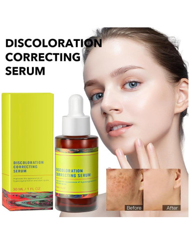 Suero Corrector de Manchas Oscuras NAILKISS 30ml