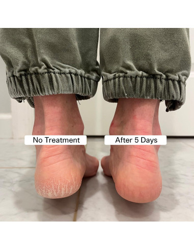 Bálsamo para Pies Agrietados Pedestrian Project 59 g