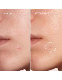 Parches para Acné MAREE Estrella - 72 Puntos Hidrocoloides 2