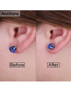 Elevadores de Pendientes Anchora Hipoalergénicos 2 Plateados 1 Dorado 2