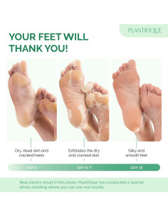 Mascarilla Exfoliante para Pies Plantifique 4 Paquetes - Suaviza y Repara 2